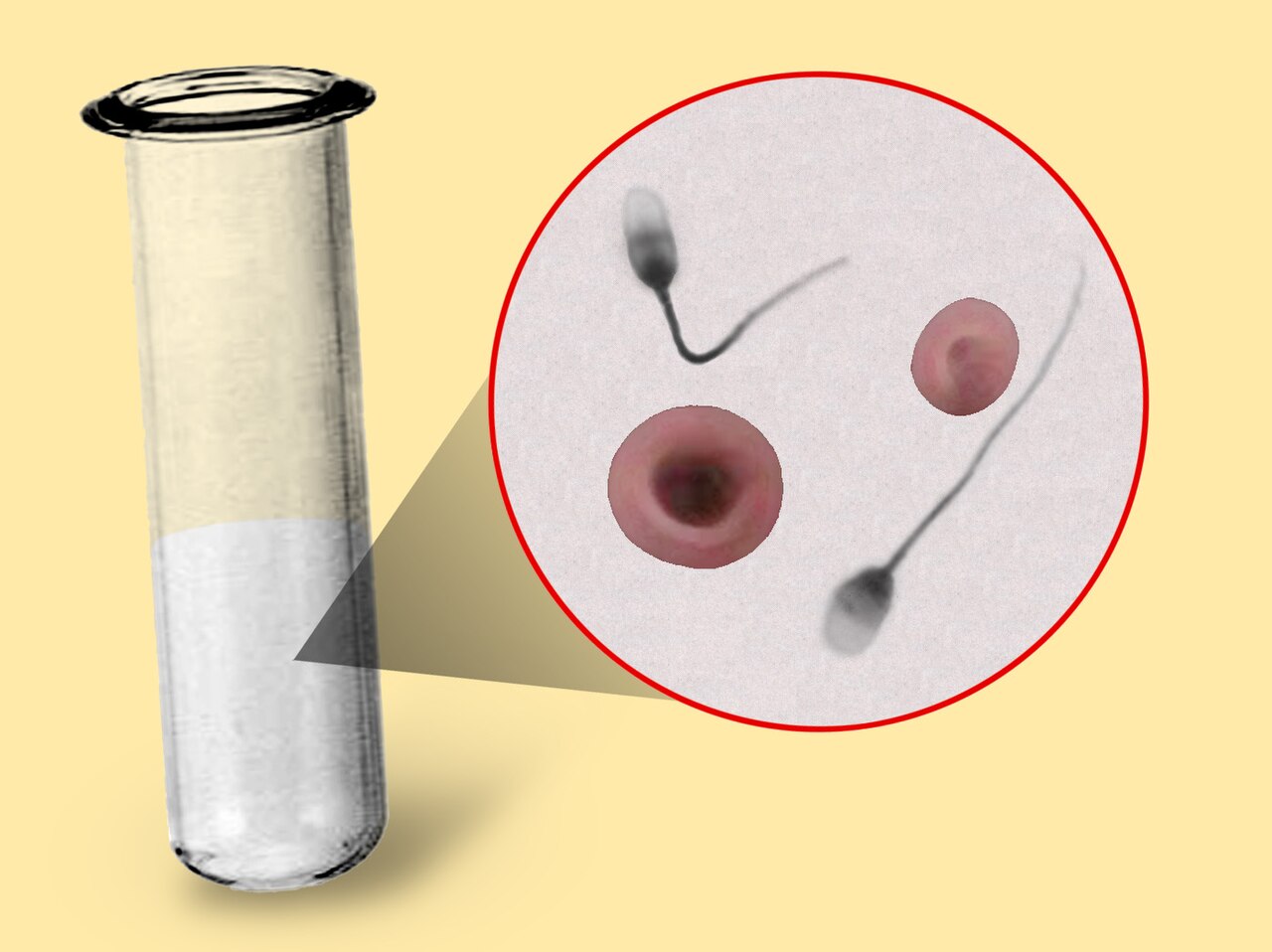 Hematospermia