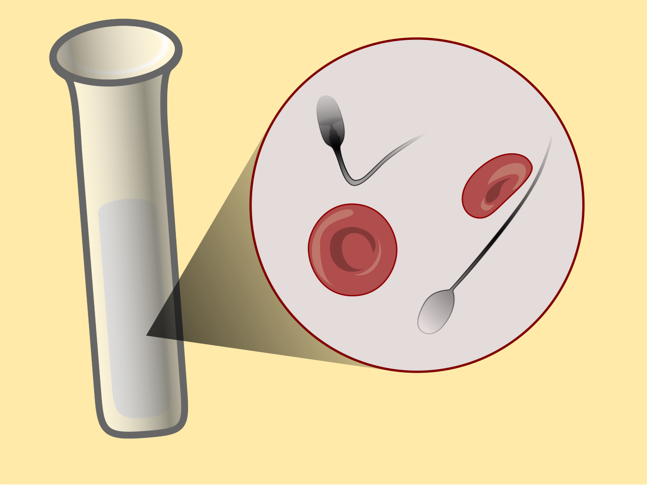 Hematospermia